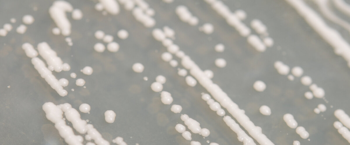 Lieviti non convenzionali - Non-conventional yeasts